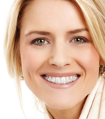 blond lady smiling with braces